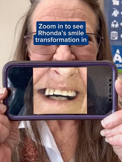 Instant Smile Dentures