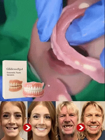 [Portable dental case included] Get your smile back with a denture.