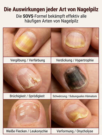 🦶Nail Repair Liquid for Toenail Fungal, Fast Effective Nail Renew Treatment, Restore Discolored Cracked Damaged Nails